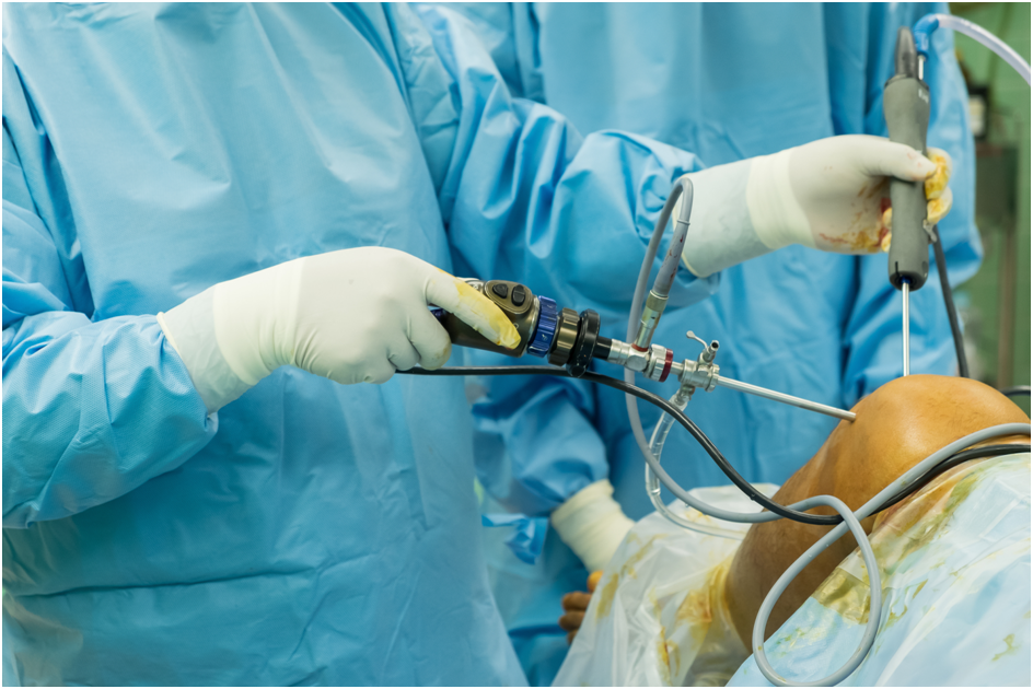 Knee Arthroscopy Surgery