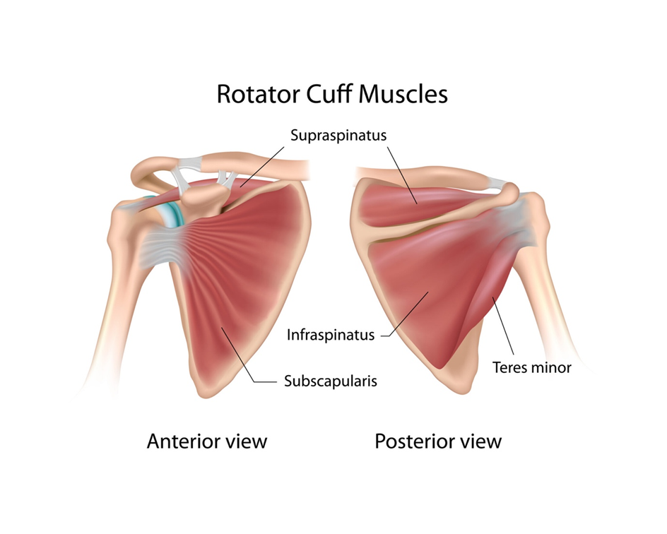 Causes of Rotator Cuff Tear